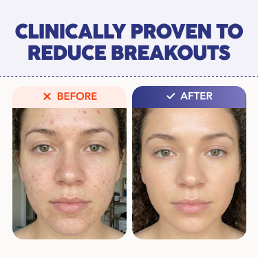 NoTrace Pillow Cleanser